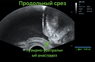 Продольный срез, 54 года